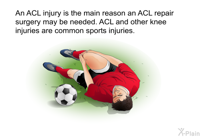 An ACL injury is the main reason an ACL repair surgery may be needed. ACL and other knee injuries are common sports injuries.