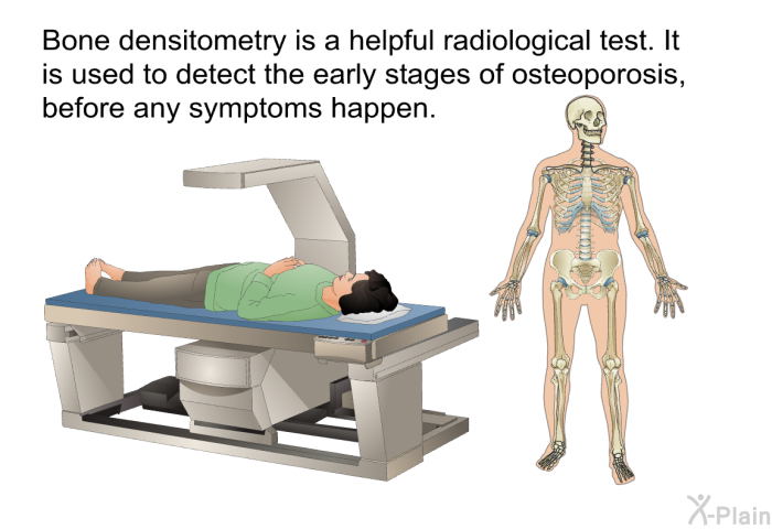 Bone densitometry is a helpful radiological test. It is used to detect the early stages of osteoporosis, before any symptoms happen.