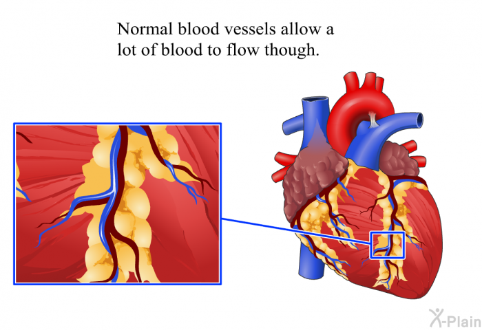 Normal blood vessels allow a lot of blood to flow though.