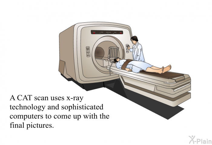 A CAT scan uses x-ray technology and sophisticated computers to come up with the final pictures.