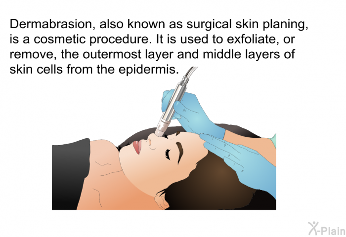 Dermabrasion, also known as surgical skin planing, is a cosmetic procedure. It is used to exfoliate, or remove, the outermost layer and middle layers of skin cells from the epidermis.