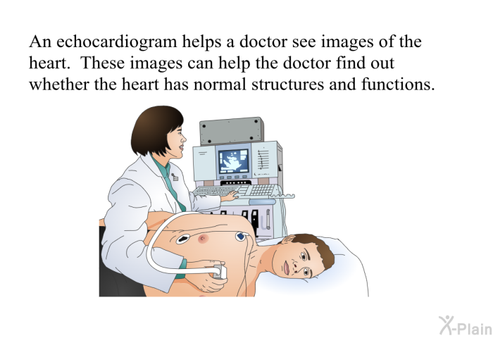 An echocardiogram helps a doctor see images of the heart. These images can help the doctor find out whether the heart has normal structures and functions.