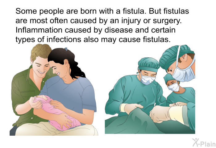 Some people are born with a fistula. But fistulas are most often caused by an injury or surgery. Inflammation caused by disease and certain types of infections also may cause fistulas.