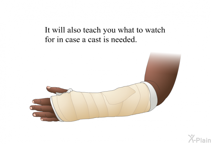 It will also teach you what to watch for in case a cast is needed.