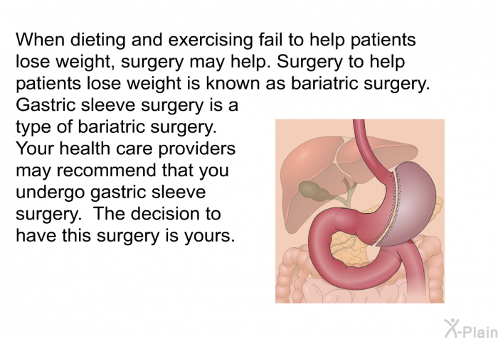 When dieting and exercising fail to help patients lose weight, surgery may help. Surgery to help patients lose weight is known as bariatric surgery. Gastric sleeve surgery is a type of bariatric surgery. Your health care providers may recommend that you undergo gastric sleeve surgery. The decision to have this surgery is yours.