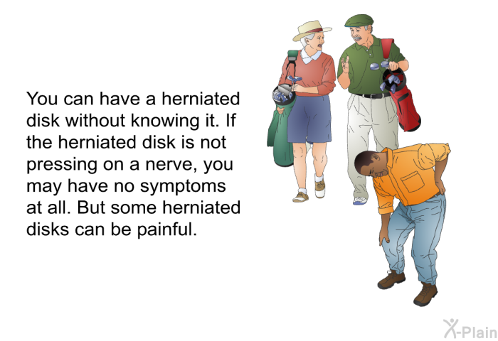 You can have a herniated disk without knowing it. If the herniated disk is not pressing on a nerve, you may have no symptoms at all. But some herniated disks can be painful.