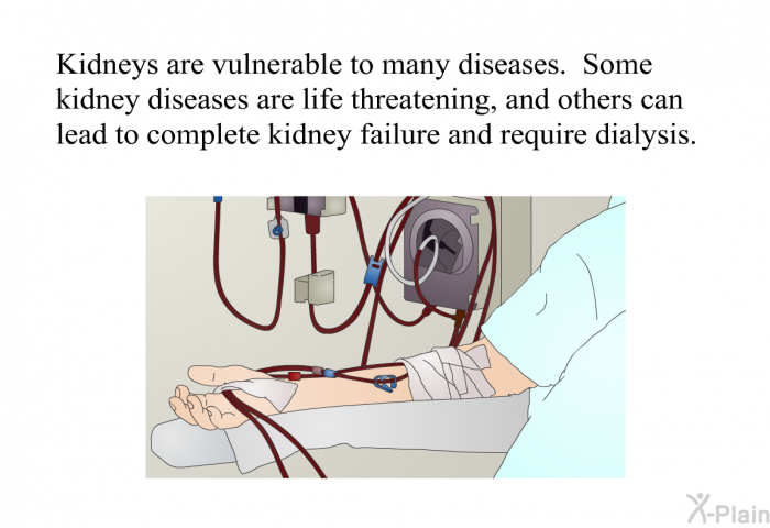 Kidneys are vulnerable to many diseases. Some kidney diseases are life threatening, and others can lead to complete kidney failure and require dialysis.