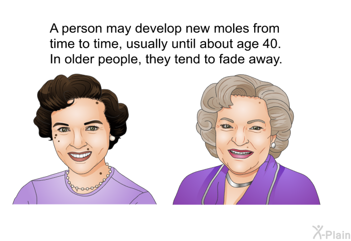 A person may develop new moles from time to time, usually until about age 40. In older people, they tend to fade away.