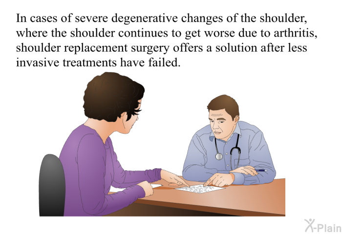 In cases of severe degenerative changes of the shoulder, where the shoulder continues to get worse due to arthritis, shoulder replacement surgery offers a solution after less invasive treatments have failed.