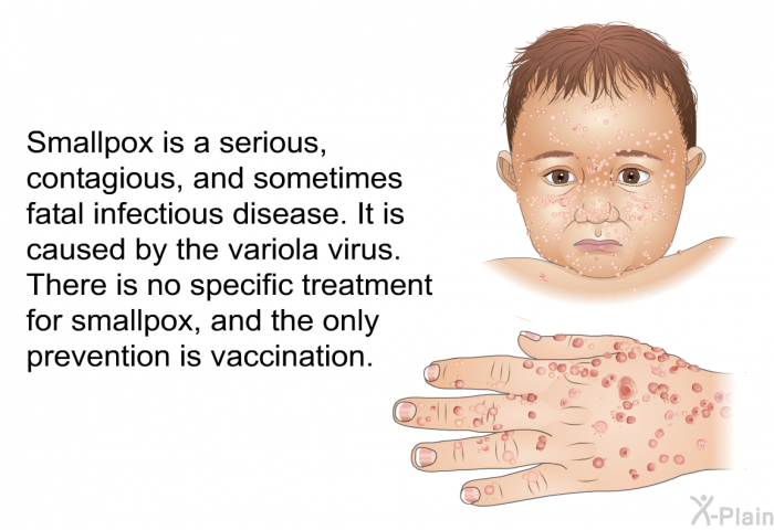 Smallpox is a serious, contagious and sometimes fatal infectious disease. It is caused by the variola virus. There is no specific treatment for smallpox, and the only prevention is vaccination.