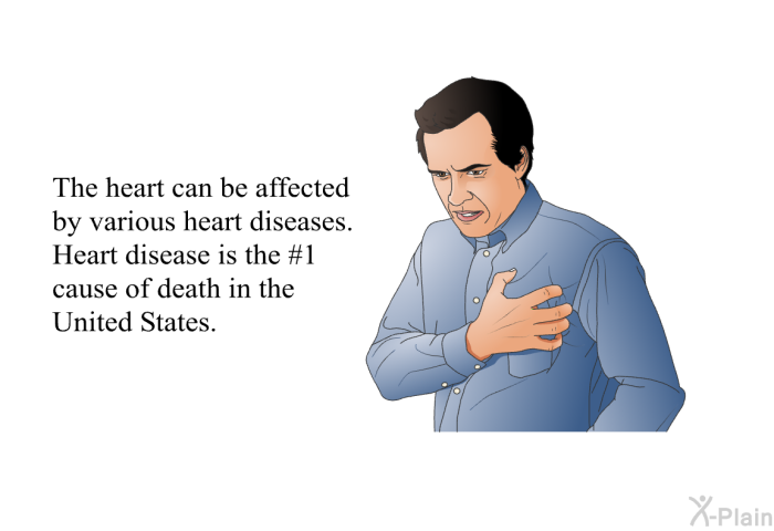 The heart can be affected by various heart diseases. Heart disease is the #1 cause of death in the United States.