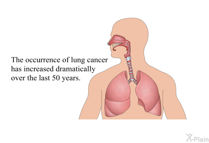 The occurrence of lung cancer has increased dramatically over the last 50 years.