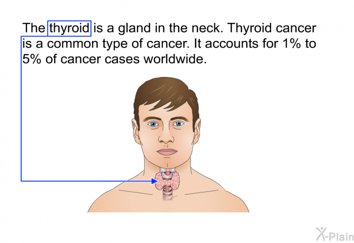 The thyroid is a gland in the neck. Thyroid cancer is a common type of cancer. It accounts for 1% to 5% of cancer cases worldwide.