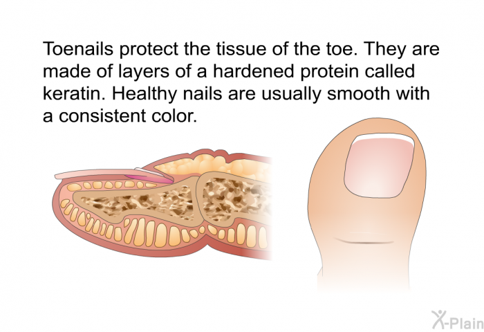 Toenails protect the tissue of the toe. They are made of layers of a hardened protein called keratin. Healthy nails are usually smooth with a consistent color.