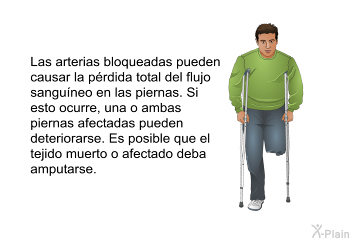 Las arterias bloqueadas pueden causar la prdida total del flujo sanguneo en las piernas. Si esto ocurre, una o ambas piernas afectadas pueden deteriorarse. Es posible que el tejido muerto o afectado deba amputarse.