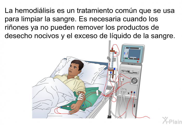 La hemodilisis es un tratamiento comn que se usa para limpiar la sangre. Es necesaria cuando los riones ya no pueden remover los productos de desecho nocivos y el exceso de lquido de la sangre.