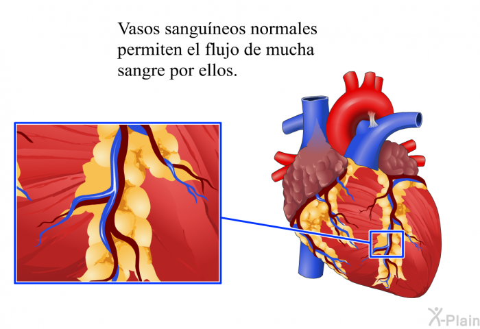 Vasos sanguneos normales permiten el flujo de mucha sangre por ellos.