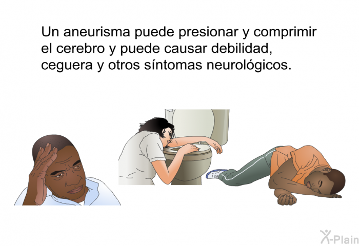 Un aneurisma puede presionar y comprimir el cerebro y puede causar debilidad, ceguera y otros sntomas neurolgicos.