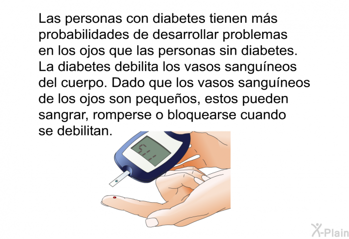 Las personas con diabetes tienen ms probabilidades de desarrollar problemas en los ojos que las personas sin diabetes. La diabetes debilita los vasos sanguneos del cuerpo. Dado que los vasos sanguneos de los ojos son pequeos, estos pueden sangrar, romperse o bloquearse cuando se debilitan.