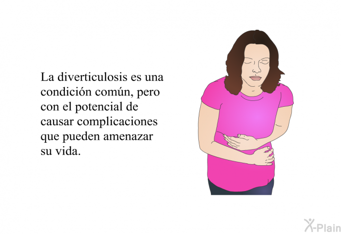 La diverticulosis es una condicin comn, pero con el potencial de causar complicaciones que pueden amenazar su vida.