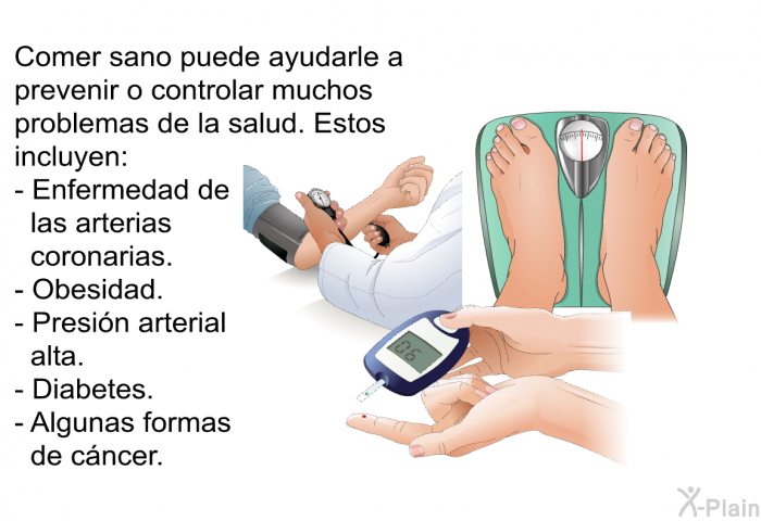 Comer sano puede ayudarle a prevenir o controlar muchos problemas de la salud. Estos incluyen:  Enfermedad de las arterias coronarias. Obesidad. Presin arterial alta. Diabetes. Algunas formas de cncer.