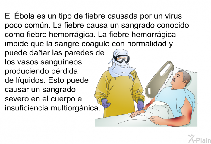 El Ébola es un tipo de fiebre causada por un virus poco comn. La fiebre causa un sangrado conocido como fiebre hemorrgica. La fiebre hemorrgica impide que la sangre coagule con normalidad y puede daar las paredes de los vasos sanguneos produciendo prdida de lquidos. Esto puede causar un sangrado severo en el cuerpo e insuficiencia multiorgnica.