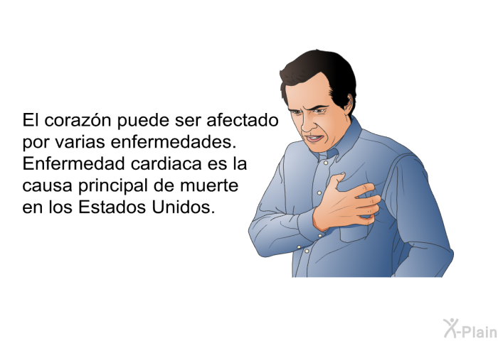 El corazn puede ser afectado por varias enfermedades. Enfermedad cardiaca<I> </I>es la causa principal de muerte en los Estados Unidos.