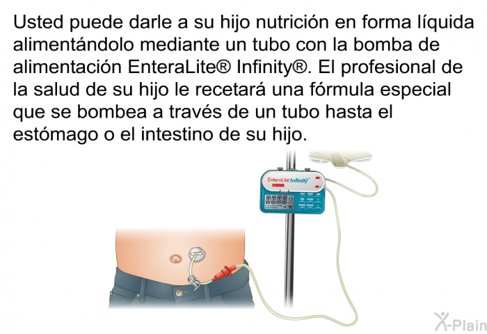 Usted puede darle a su hijo nutricin en forma lquida alimentndolo mediante un tubo con la bomba de alimentacin EnteraLite<SUP> </SUP> Infinity<SUP> </SUP>. El profesional de la salud de su hijo le recetar una frmula especial que se bombea a travs de un tubo hasta el estmago o el intestino de su hijo.