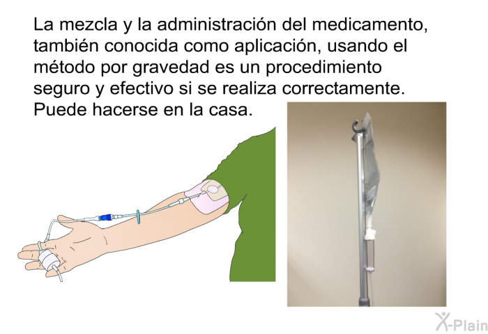 La mezcla y la administracin del medicamento, tambin conocida como aplicacin, usando el mtodo por gravedad es un procedimiento seguro y efectivo si se realiza correctamente. Puede hacerse en la casa.