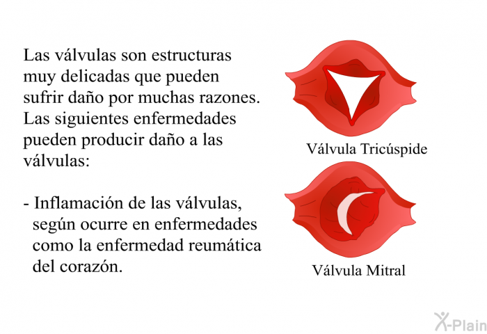 Las vlvulas son estructuras muy delicadas que pueden sufrir dao por muchas razones. Las siguientes enfermedades pueden producir dao a las vlvulas:  Inflamacin de las vlvulas, segn ocurre en enfermedades como la enfermedad reumtica del corazn.