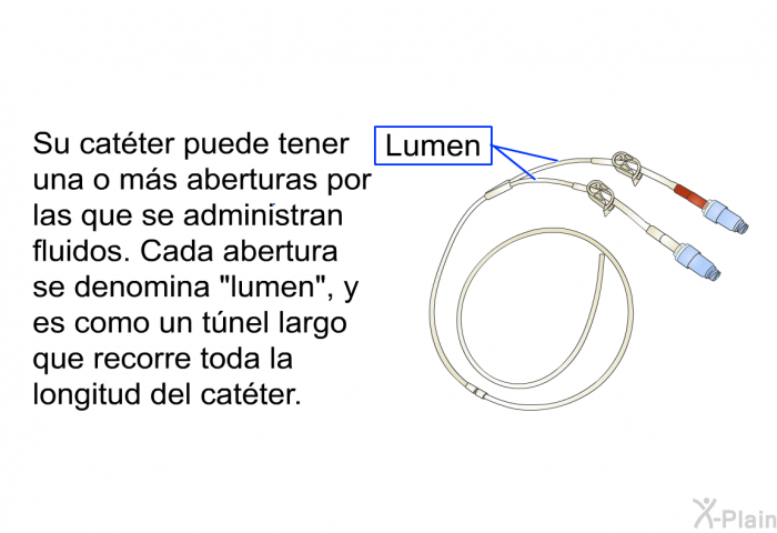 Su catter puede tener una o ms aberturas por las que se administran fluidos. Cada abertura se denomina “lumen”, y es como un tnel largo que recorre toda la longitud del catter.