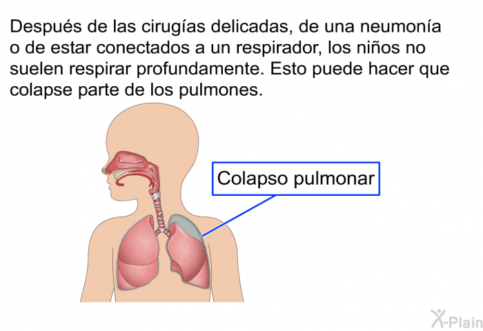 Despus de las cirugas delicadas, de una neumona o de estar conectados a un respirador, los nios no suelen respirar profundamente. Esto puede hacer que colapse parte de los pulmones.