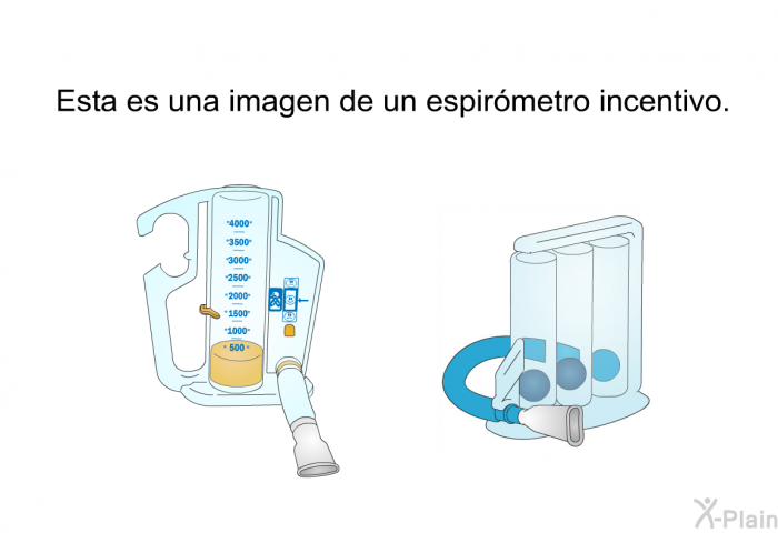 Esta es una imagen de un espirmetro incentivo.