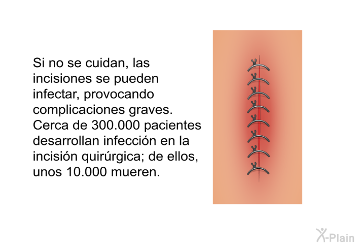 Si no se cuidan, las incisiones se pueden infectar, provocando complicaciones graves. Cerca de 300.000 pacientes desarrollan infeccin en la incisin quirrgica; de ellos, unos 10.000 mueren.