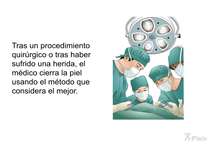 Tras un procedimiento quirrgico o tras haber sufrido una herida, el mdico cierra la piel usando el mtodo que considera el mejor.