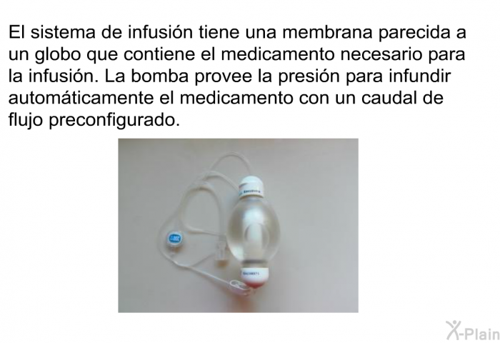 El sistema de infusin tiene una membrana parecida a un globo que contiene el medicamento necesario para la infusin. La bomba provee la presin para infundir automticamente el medicamento con un caudal de flujo preconfigurado.