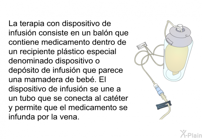 La terapia con dispositivo de infusin consiste en un baln que contiene medicamento dentro de un recipiente plstico especial denominado dispositivo o depsito de infusin que parece una mamadera de beb. El dispositivo de infusin se une a un tubo que se conecta al catter y permite que el medicamento se infunda por la vena.