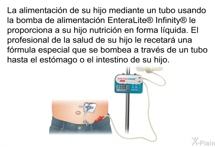 La alimentacin de su hijo mediante un tubo usando la bomba de alimentacin EnteraLite<SUP> </SUP> Infinity<SUP> </SUP> le proporciona a su hijo nutricin en forma lquida. El profesional de la salud de su hijo le recetar una frmula especial que se bombea a travs de un tubo hasta el estmago o el intestino de su hijo.