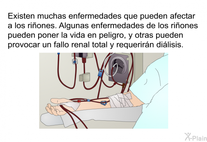 Existen muchas enfermedades que pueden afectar a los riones. Algunas enfermedades de los riones pueden poner la vida en peligro, y otras pueden provocar un fallo renal total y requerirn dilisis.