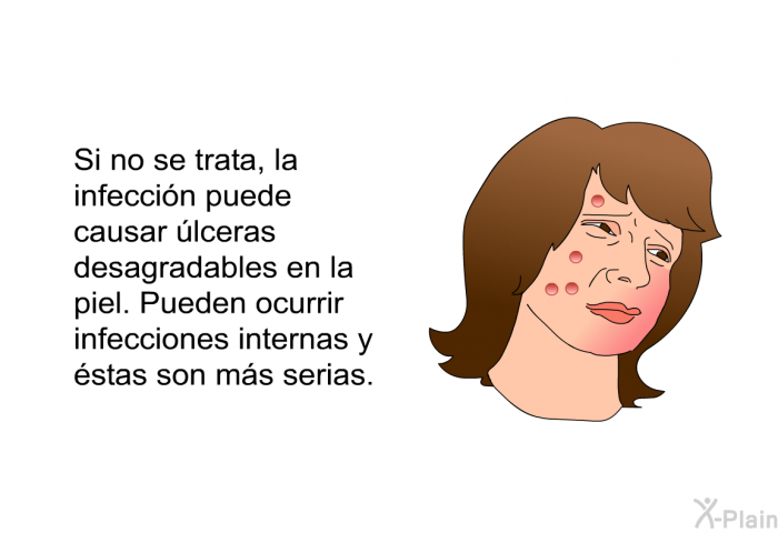 Si no se trata, la infeccin puede causar lceras desagradables en la piel. Pueden ocurrir infecciones internas y stas son ms serias.