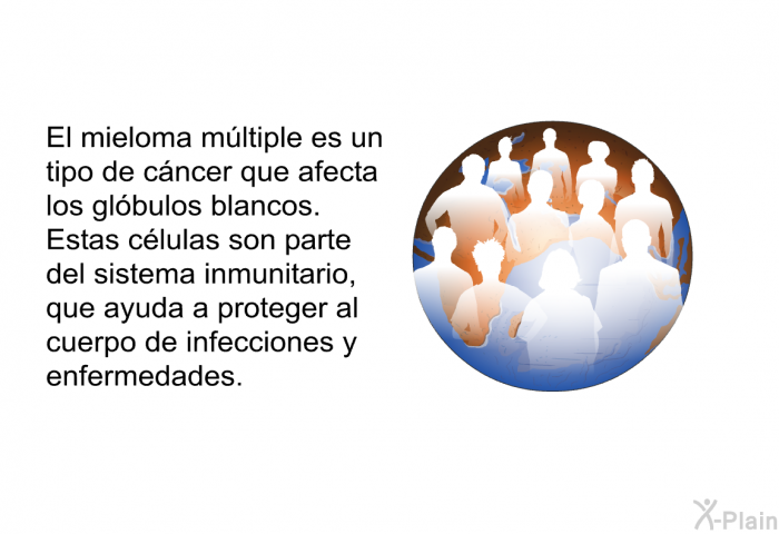 El mieloma mltiple es un tipo de cncer que afecta los glbulos blancos. Estas clulas son parte del sistema inmunitario, que ayuda a proteger al cuerpo de infecciones y enfermedades.