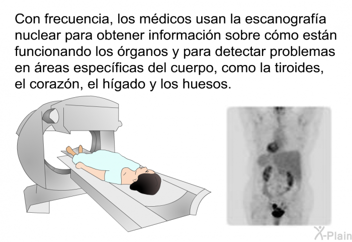 Con frecuencia, los mdicos usan la escanografa nuclear para obtener informacin sobre cmo estn funcionando los rganos y para detectar problemas en reas especficas del cuerpo, como la tiroides, el corazn, el hgado y los huesos.