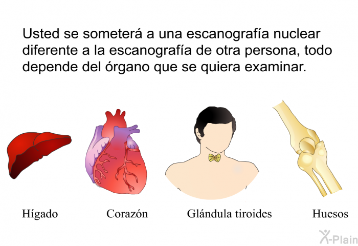 Usted se someter a una escanografa nuclear diferente a la escanografa de otra persona, todo depende del rgano que se quiera examinar.