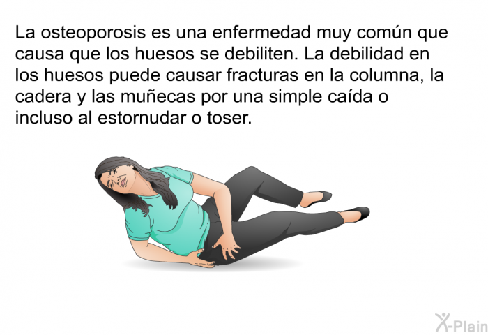 La osteoporosis es una enfermedad muy comn que causa que los huesos se debiliten. La debilidad en los huesos puede causar fracturas en la columna, la cadera y las muecas por una simple cada o incluso al estornudar o toser.