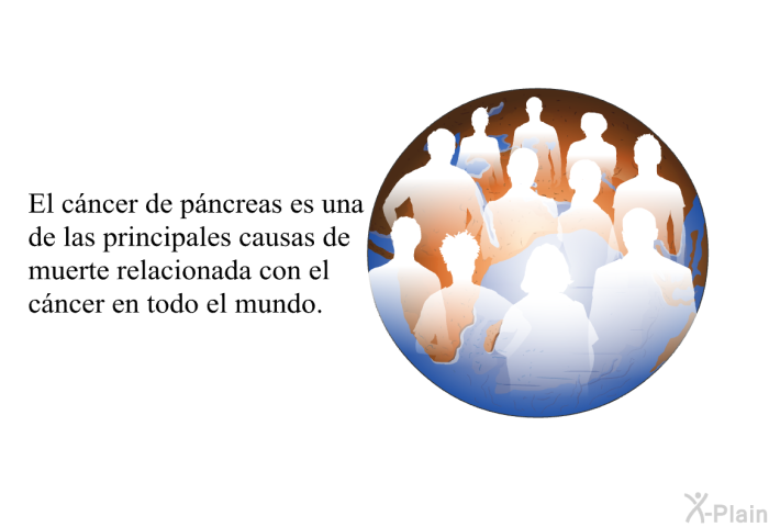 El cncer de pncreas es una de las principales causas de muerte relacionada con el cncer en todo el mundo.