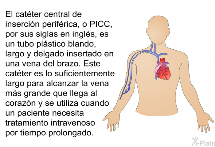 El catter central de insercin perifrica, o PICC, por sus siglas en ingls, es un tubo plstico blando, largo y delgado insertado en una vena del brazo. Este catter es lo suficientemente largo para alcanzar la vena ms grande que llega al corazn y se utiliza cuando un paciente necesita tratamiento intravenoso por tiempo prolongado.