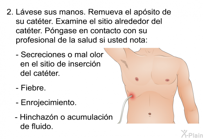 Lvese sus manos. Remueva el apsito de su catter. Examine el sitio alrededor del catter. Pngase en contacto con su profesional de la salud si usted nota:   Secreciones o mal olor en el sitio de insercin del catter. Fiebre. Enrojecimiento. Hinchazn o acumulacin de fluido.