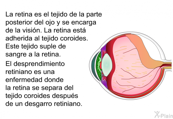 La retina es el tejido de la parte posterior del ojo y se encarga de la visin. La retina est adherida al tejido coroides. Este tejido suple de sangre a la retina. El desprendimiento retiniano es una enfermedad donde la retina se separa del tejido coroides despus de un desgarro retiniano.