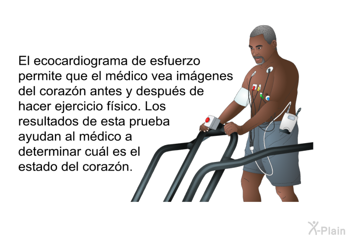 El <I>ecocardiograma de esfuerzo</I> permite que el mdico vea imgenes del corazn antes y despus de hacer ejercicio fsico. Los resultados de esta prueba ayudan al mdico a determinar cul es el estado del corazn.