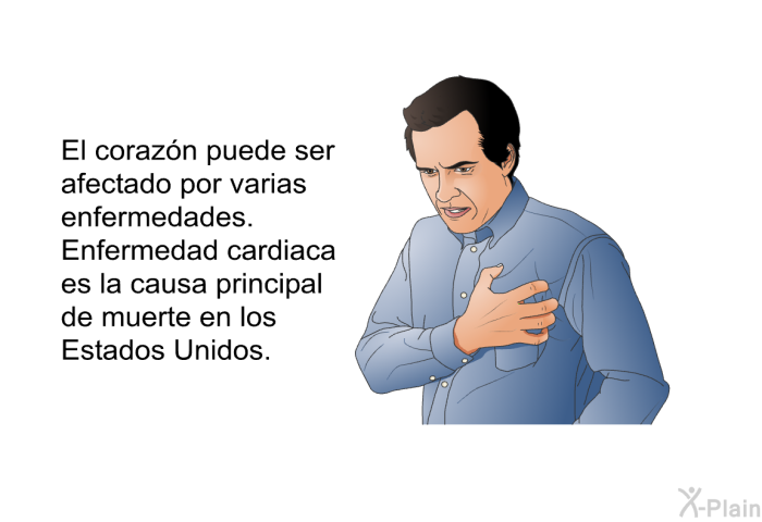 El corazn puede ser afectado por varias enfermedades. Enfermedad cardiaca<I> </I>es la causa principal de muerte en los Estados Unidos.